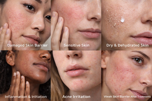Esther Collective Skin Rescue System – Barrier Repair Skincare Set for Sensitive, Irritated & Dry Skin by Esther Collective store
