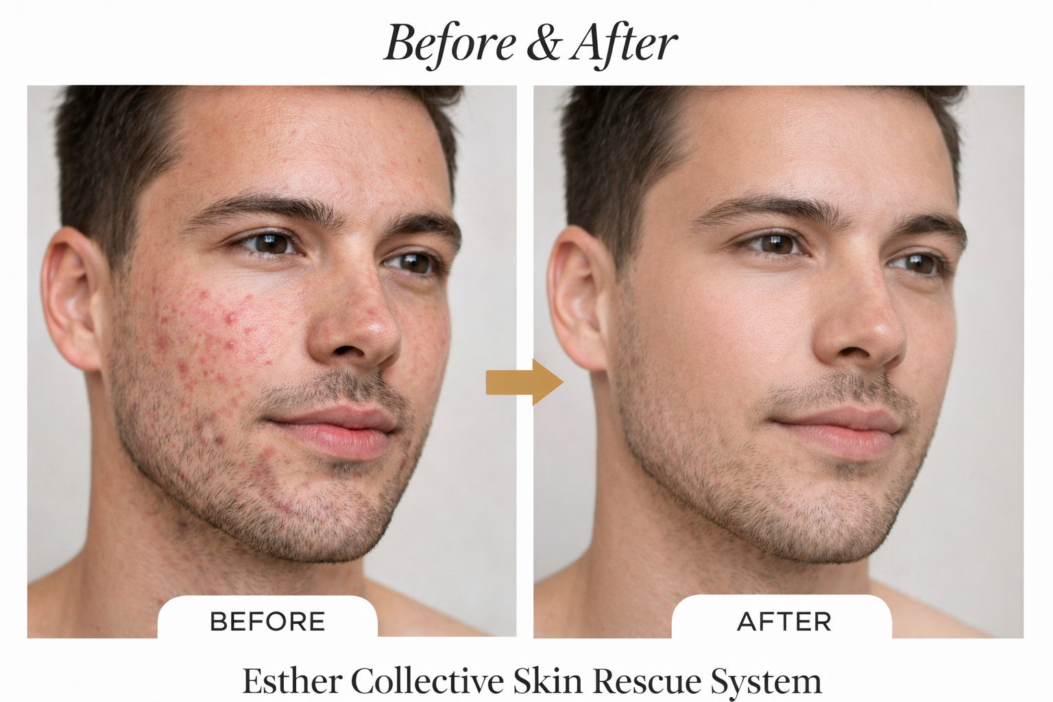 Esther Collective Skin Rescue System – Barrier Repair Skincare Set for Sensitive, Irritated & Dry Skin by Esther Collective store